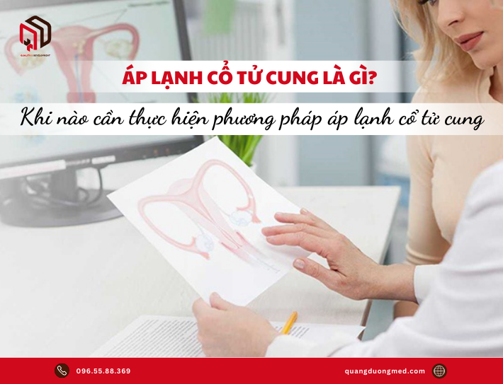 Khi nào cần thực hiện phương pháp áp lạnh cổ tử cung?