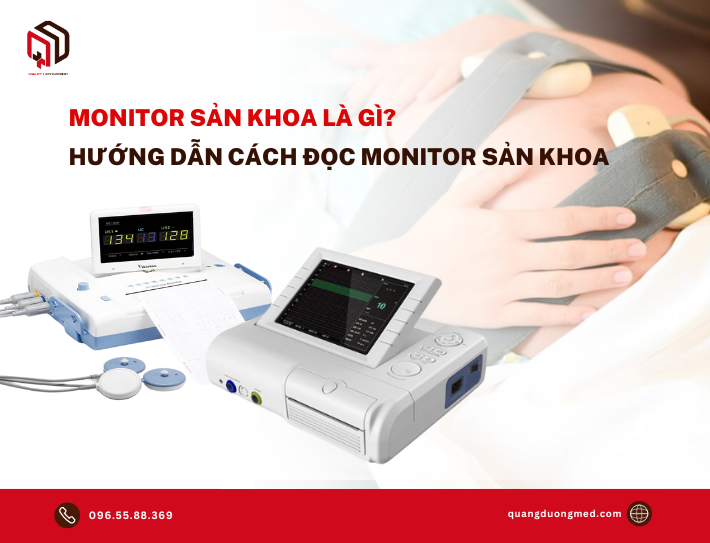 Monitor sản khoa là gì? Hướng dẫn cách đọc monitor sản khoa