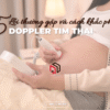5-loi-thuong-gap-khi-su-dung-doppler-tim-thai-va-cach-khac-phuc