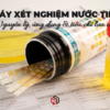 may-xet-nghiem-nuoc-tieu-nguyen-ly-ung-dung-tieu-chi-lua-chon