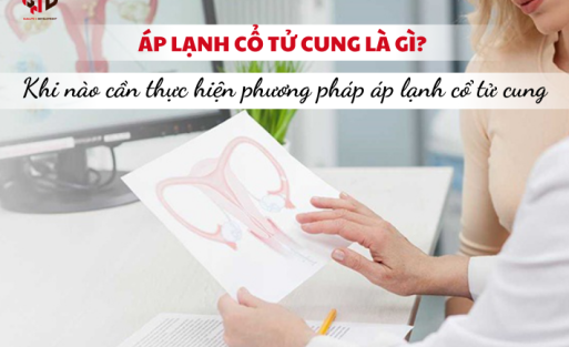 Khi nào cần thực hiện phương pháp áp lạnh cổ tử cung?