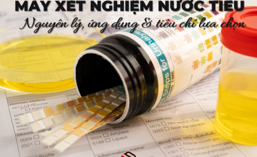 may-xet-nghiem-nuoc-tieu-nguyen-ly-ung-dung-tieu-chi-lua-chon